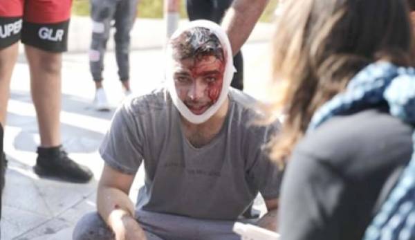 Σπαρτιάτης ο φοιτητής που χτυπήθηκε στην πορεία της Αθήνας! (photos)