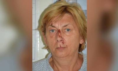 Κροατία: Γυναίκα βρέθηκε τραυματισμένη σε νησί - Δεν θυμάται το όνομά της ούτε πώς πήγε εκεί