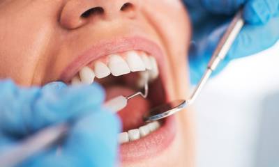 ΗΠΑ: Οδοντίατρος έσπαγε τα δόντια των ασθενών του επίτηδες, για να βάλει θήκες- «Έβγαλε εκατομμύρια»