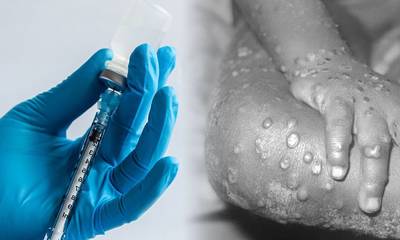Ευλογιά των πιθήκων: Το εμβόλιο «στο τραπέζι» της Επιτροπής Εμβολιασμού