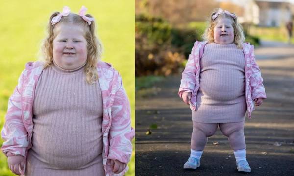 Βρετανία: Η πεντάχρονη που ζυγίζει 45 κιλά πάσχει από σύνδρομο που την κάνει διαρκώς να πεινάει