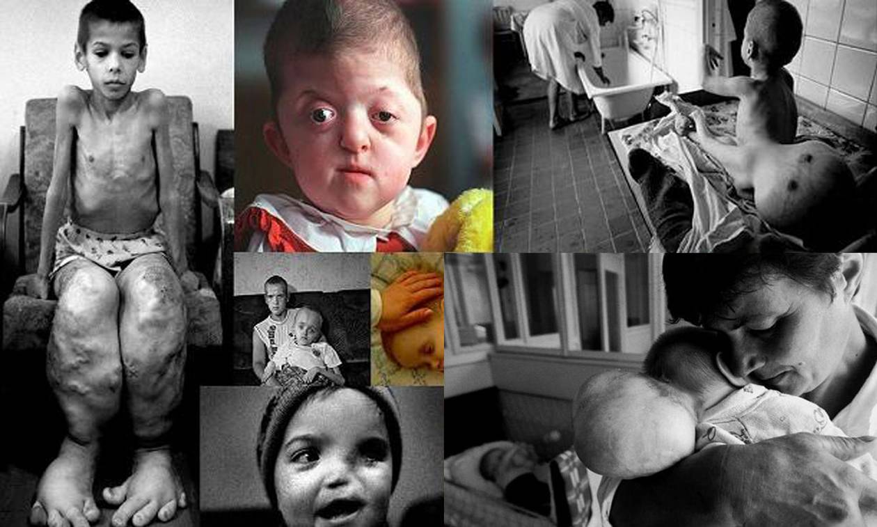https://cdn.np-media.gr/media/news/2023/04/26/88700/photos/snapshot/CHERNOBYL-KIDS-2.jpg