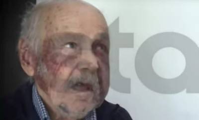 Ληστές τέρατα σε σπίτι 90χρονου - «Μου έβγαλαν τα δόντια» λέει ο τραυματισμένος παππούς (video)