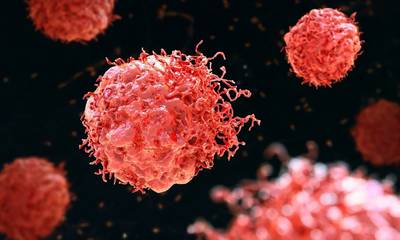 ΗΠΑ: Ελπίδες από χημειοθεραπεία ικανή να σκοτώσει όλους τους συμπαγείς καρκινικούς όγκους