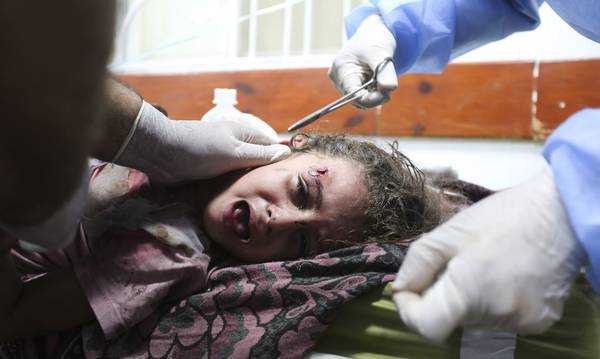 «Ξαναβάλτε μου τα πόδια μου» – Η φρίκη των ακρωτηριασμένων παιδιών στην εμπόλεμη Λωρίδα της Γάζας