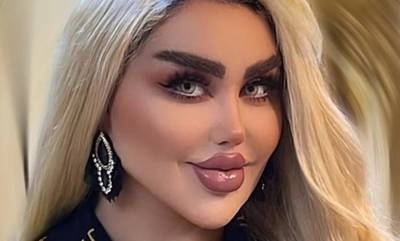 Ιρακινή παρουσιάστρια έκανε 43 πλαστικές για να μεταμορφωθεί σε Barbie - «Βροχή» τα σχόλια